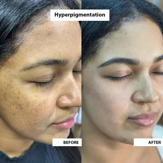 Super Serum + image 2