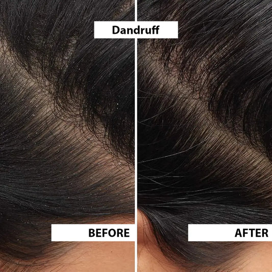 Glycool Shampoo image 2