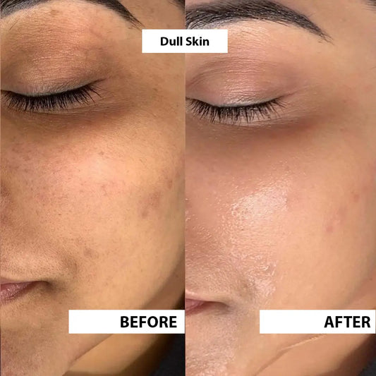 Skin Care Combo image 3