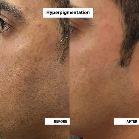Super Serum + image 3